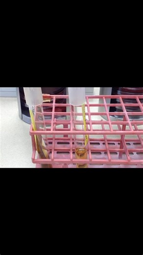 Bile esculin test 😍😍 #Microbiology #lablife #medicallaboratoryscience | Lab life