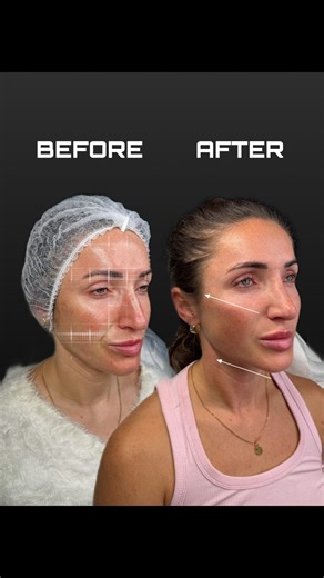 8.6K views · 55 reactions | Full Face Scanning — Beyond Just One...