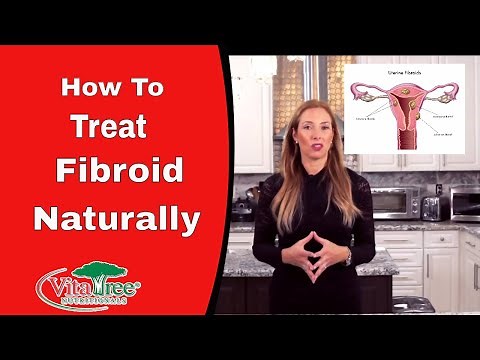 Fibroids : How to Treat Fibroids Naturally : Herbal Fibroid Remedies - VitaLife Show Episode 289
