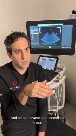 What does a statin actually do? 💊❤️ Statins are one of the most common medications prescribed for heart health but their benefits go beyond just lowering cholesterol. As Dr. Elie Dib explains: “Cardiovascular disease is a mixture. It's not just all cholesterol and it's not all inflammation; it's a mixture of both. A statin kind of gives you a little bit of both, so it reduces your cholesterol levels, but at the same time, it also reduces inflammation, which then reduces your risk of developing 