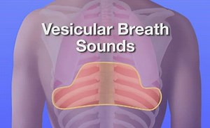Auscultation of Breath Sounds: Tracheal, broncial, bronchovesicular and vesicular breath sounds