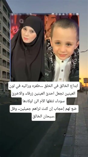 ابداع الخالق في الخلق طفره وراثيه في لون العينين تجعل احدئ العينين زرقاء والاخرئ سوداء تنقلها الأم
