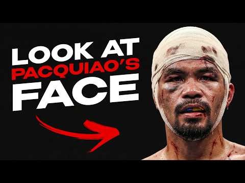 This Fighter Almost KILLED Manny Pacquiao - Pure VIOLENCE!