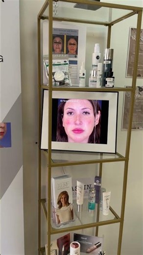 XERF Skin Tightening in San Diego | Before & After Results #shorts