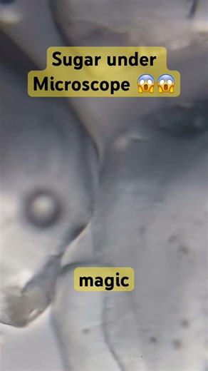 Sugar Under Microscope 😱 You’ll Never See Sugar the Same Way Again!