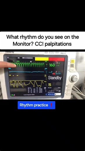 The Stubborn Dr | Palpitations! What is your diagnosis ? Comment down ⬇️👇🏾 #ecg #ekg #cardiology #paramedic #nursing #medizin #cardiologia ##medicina... | Instagram