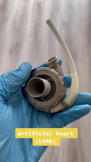 Understanding Left Ventricular Assist Devices for Heart Health