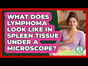 What Does Lymphoma Look Like In Spleen Tissue Under A Microscope? - Lymphoma Support Network