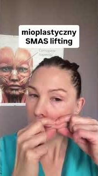 Mioplastyczny SMAS lifting