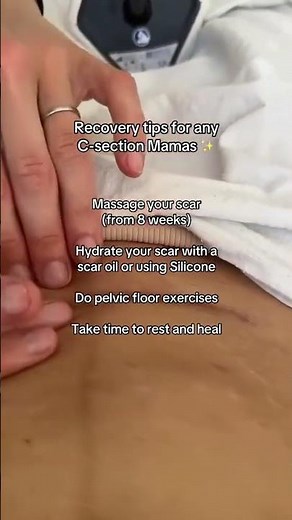 C section Recovery Tips you need to know