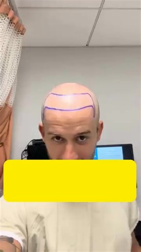 💡 New Hair Regrowth Research Is CHANGING Everything! Discover the latest scientific breakthroughs designed to restore confidence and results. ✅ Backed by Clinical Studies ✅ Non-Invasive Solutions ✅ Promising Results for Men & Women | Health Pulse