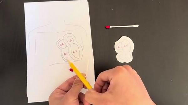 Cardiac Probe Marker Orientation for ECHO Ultrasound