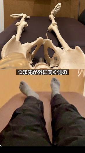 つま先が外に向くことから考えられるカラダへの影響と身体機能の左右差について #扁平足 #反り腰 #腰痛 #坐骨神経痛 #巣鴨 #整体院晃福 整体院 晃福-kofuku- 豊島区巣鴨4-7-8大塚ベース3号 (JR山手線大塚駅徒歩7分) ご予約･オンライン指導のお問い合わせはHPのメール又はLINEから！またモニター様の募集もしています。詳細はHP内のブログをご確認ください。腰痛やカラダの痛みに関するご質問なども各SNSやLINEからお気軽に^ ^
