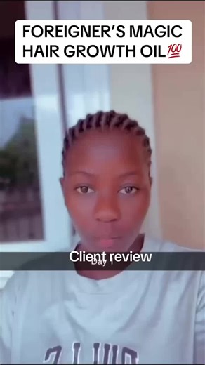 Effective Hair Growth Products for Better Results