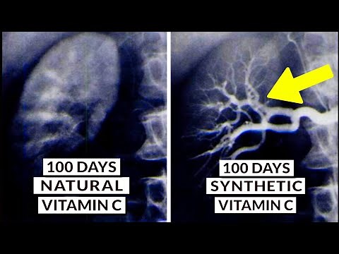 We Finally Know What Type Of Vitamin C Is Best