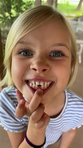 Loose Tooth! 🦷