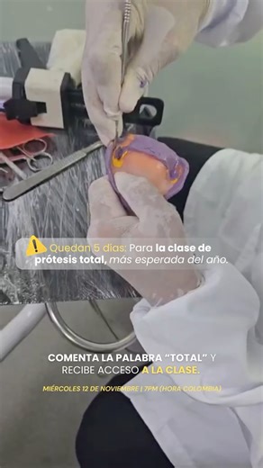 Cursos • Clases • Odontólogos • Técnicos 🦷 on Instagram: "La precisión en el manejo del postdam define la succión y la estabilidad final de la prótesis total. Aprende el método clínico completo en la clase gratuita “3 Fundamentos para el Éxito de la Prótesis Total” con el Dr. Alfredo Quintero. 🗓️ Miércoles 12 de noviembre – 7:00 p.m. (Hora Colombia) 💬 Comenta “TOTAL” para recibir tu acceso gratuito."