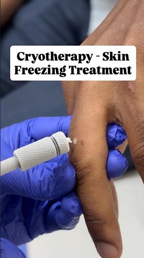 Cryotherapy