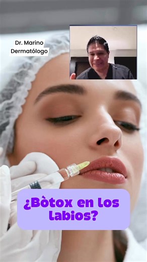 🫦¿Bótox en los labios?🫦 #dermatologia #labios #arrugas #botox #acidohialuronico | Dr Marino Dermatólogo