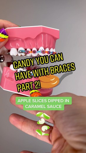 Braces By Britt Official® on TikTok