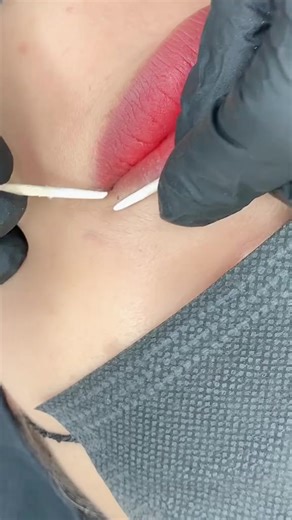 Blackhead popping #skincare #popping #blackhead #Acne