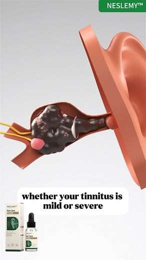 Natural Ear Relief Drops – Soothe & Refresh Your Ears! Tired of ear discomfort, itching, or annoying ringing? Our gentle, plant-based Ear Care Drops are here to help! 🌿 Made with Safflower, Magnolia, and other natural extracts, these drops provide fast, soothing relief without harsh chemicals. ✔ Calms itchiness & irritation ✔ Helps reduce ear discomfort & discharge ✔ Non-irritating & safe for sensitive ears Breathe easy—your ears deserve the best! Try Ear Care Drops today for a fresh, natural s