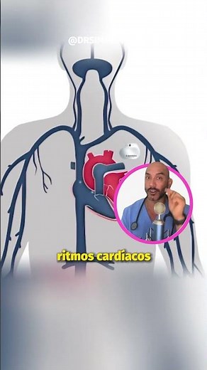 IMPLANTABLE AUTOMATIC DEFIBRILLATORS: 24-hour cardiac protection.