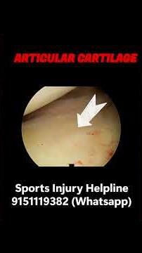 Diagnostic Shoulder Arthroscopy #arthroscopicsurgery #shoulderinjury #sgpgilucknow