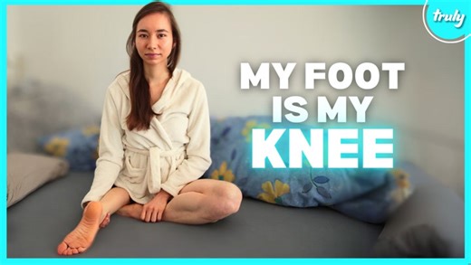 Doctors Turned My Foot Into My Knee | BORN DIFFERENT