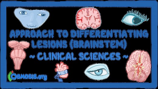 Approach to differentiating lesions (brainstem): Video & Meaning | Osmosis