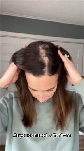 Suffering from Hair Loss? 3 Lace Front Toppers I Actually Recommend! | UniWigs Airy Elegance