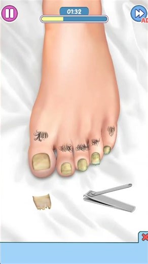 Dirty Feet Cleaning Game | Clean the Messy Foot Step by Step! 🦶✨|##gameplay #cleaninggame #foot