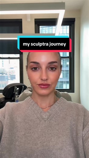 My Sculptra Journey: One Day Post-Injections Update