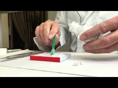 Clinical Techniques: Cementation