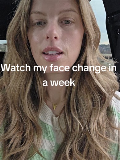 Watch my face change in one week... microneedling in March is scheduled #fyp #wrinkles #aging #skincareroutine #skincare