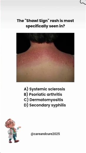 NURSING EXAM Prep Made EASY?nursing quiz #science#medical #nursing #medicalscience #medicalstudents