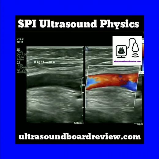 Ultrasound Physics