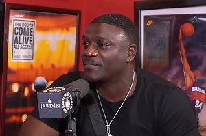 Akon Recalls 'Painful Part’ of $7,500 Hair Transplant in Turkey, Responds to Memes About His Hairline