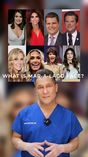 Gary Motykie, MD FACS on Instagram: "What is Mar-a-lago face and is it a real thing?"