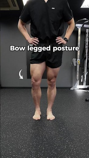 High Arch? Bow Leg? Leg Shape?