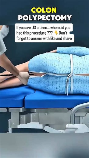 DIMA on Instagram: "A colon polypectomy is a medical procedure used to remove polyps from the lining of the colon. These polyps are often found during a colonoscopy and, while many are harmless, some can develop into colorectal cancer if left untreated. Early detection and removal are key steps in preventing colon cancer and protecting long-term digestive health. Regular screenings, especially after age 45 or for those with a family history, are strongly recommended. Your health is your greatest