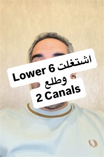 Exploring Lower First Molar Canal Anatomy