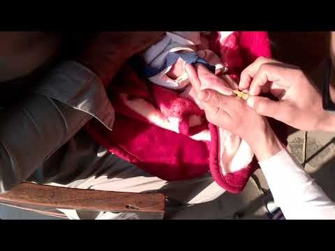 How to Insert a Cannula: Step by Step Guide