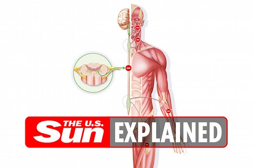 What is ALS and why is it called Lou Gehrig's disease?