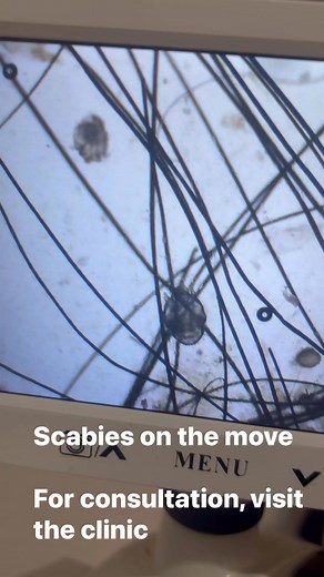 Scabies . Sarcoptic mange | Eliros Vet Clinic1