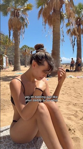 NOT hiding my baldspots in public👩🏻‍🦲| Exposure Therapy | #alopecia