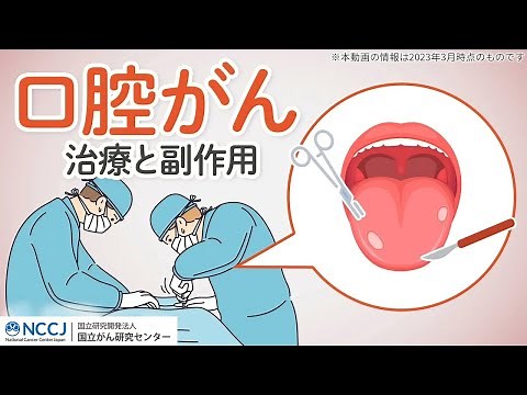 【口腔がん】治療の選択肢と治療後の副作用について徹底解説！