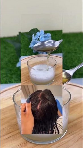 CABELO sem.caspa e seborreia #dicascapilares #cabelo