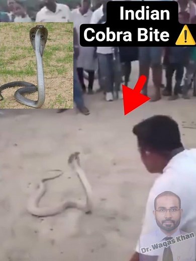 Snakebite Management Explained #mbbs