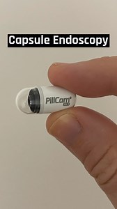 Pillcam - Capsule Endoscopy. #medical #innovation #technology #facts #DidYouKnow #awareness | Medical Journal Daily